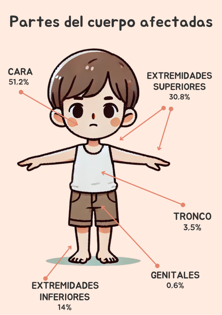 Ilustración infantil que indica las partes del cuerpo más afectadas por mordeduras de perro en niños, con porcentajes por zona