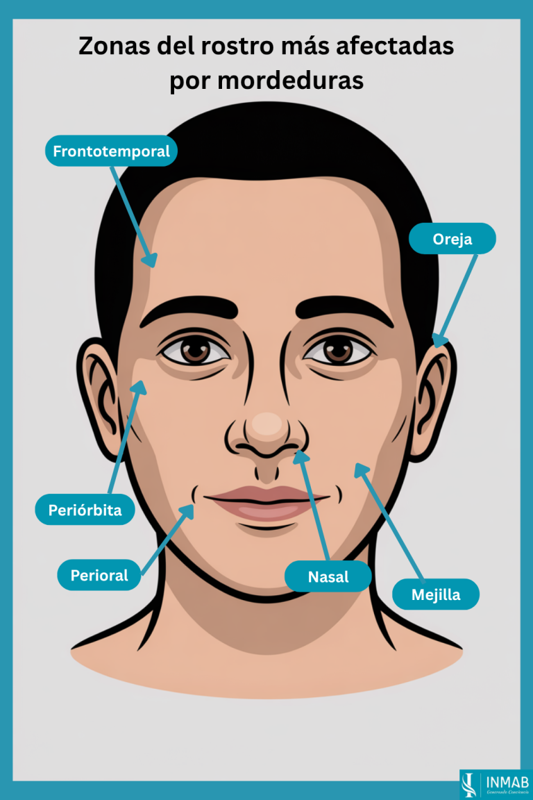 Zonas del rostro más afectadas por mordeduras - INMAB Ilustración de la cara que señala las zonas más afectadas por mordeduras: perioral, nariz, oreja, mejilla, periórbita y frente.